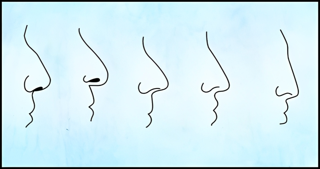 No momento você está vendo Por que você deve escolher um parceiro de acordo com o formato do nariz?